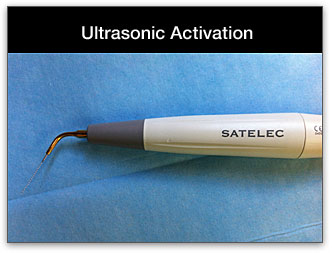 ultrasonic